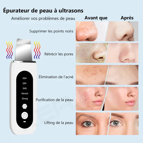 ultrasonic face skin scrubber 