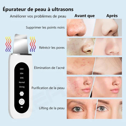 épurateur ultrasonique de peau pour visage