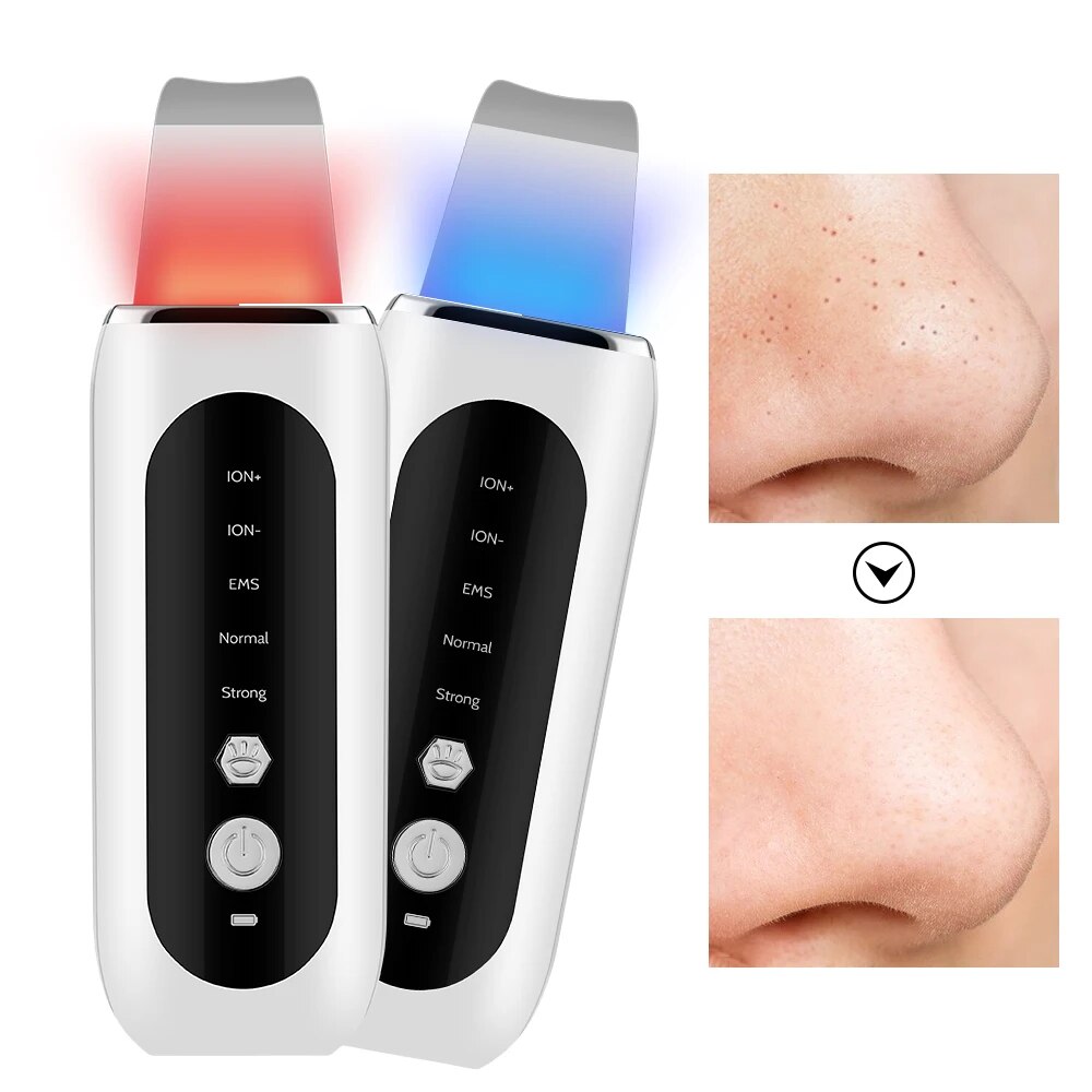 ultrasonic face skin scrubber 